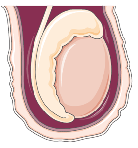 Hodenhüllen im Schnitt