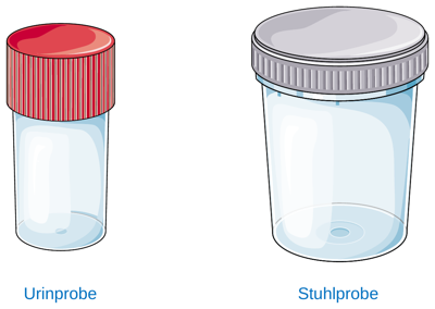 Gefäß für die Urinprobe